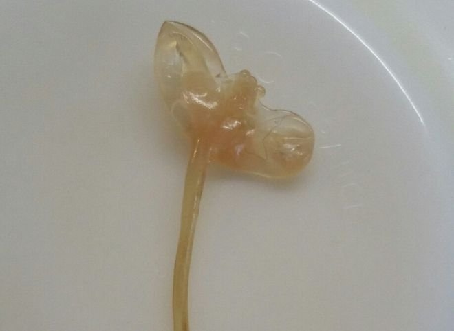 Рязанка обнаружила паразита в рыбе из гипермаркета «Глобус»