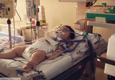 Раненному в Гюмри мальчику помогут российские медики