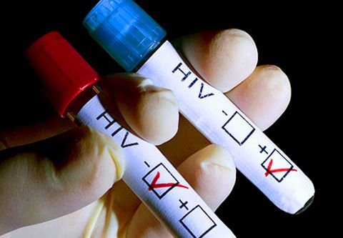 В Думе поддержали инициативу рязанки о тестировании на ВИЧ