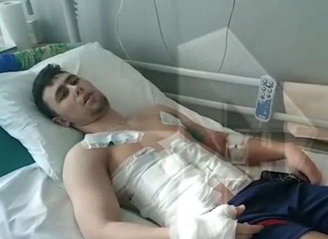 Рязанец, получивший 12 ножевых ранений, рассказал подробности драки (видео)