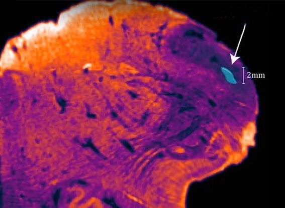 Ученые открыли новый участок человеческого мозга