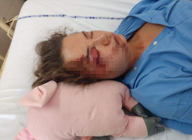 26-летняя россиянка разбилась на байке в Гоа