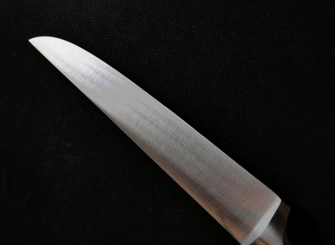 Рязанские врачи извлекли у мужчины лезвие ножа из поясницы