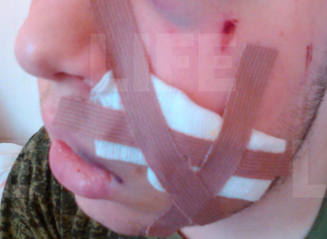 В Рязани школьник ударил одноклассника ножом в лицо