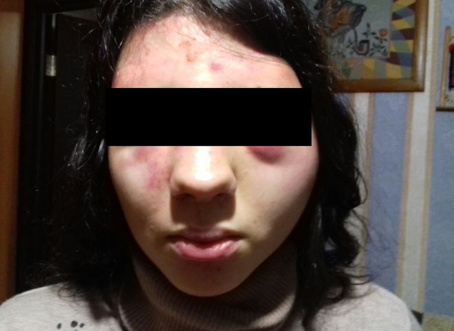 В центре Рязани трое неизвестных жестоко избили девушку