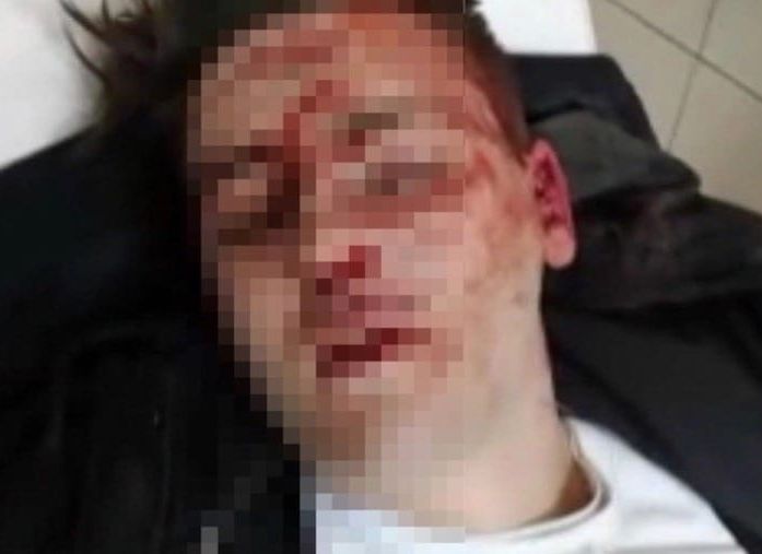 Уголовное дело об избиении в рязанском баре Svoboda прекращено