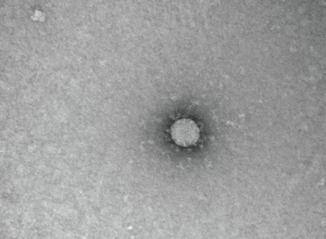 Установлена температура гибели коронавируса