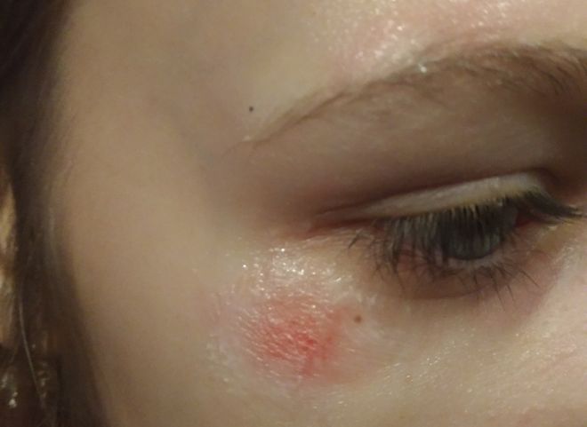 В Рязани девочка получила травму во время давки в маршрутке