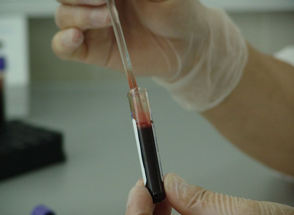 В Рязанской области откроется производство препаратов на основе плазмы крови