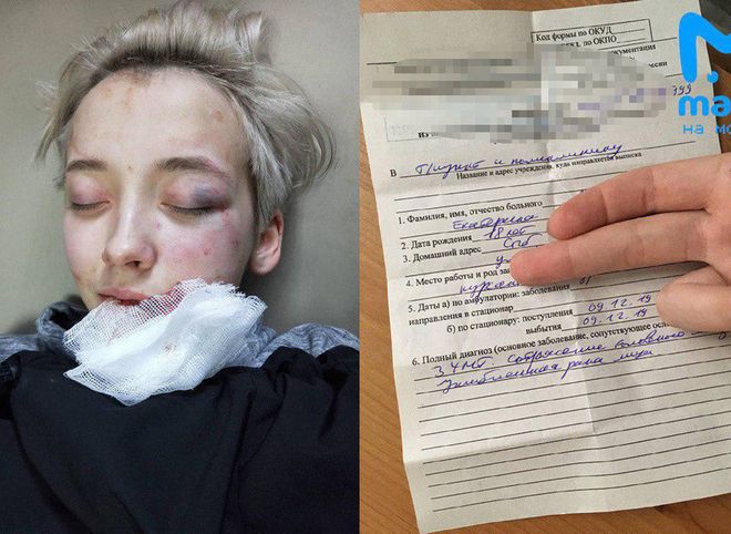 В Санкт-Петербурге задержаны подростки, избившие 18-летнюю студентку