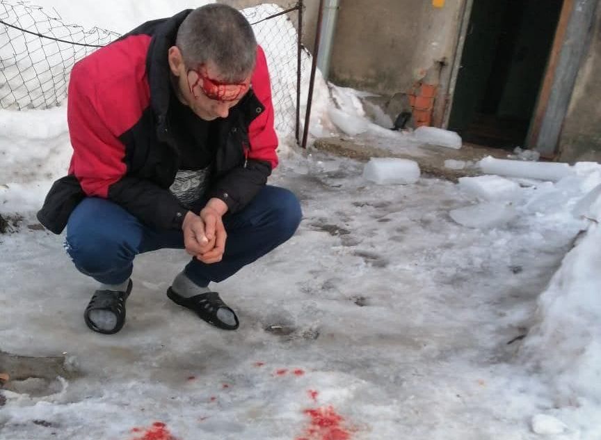 В Рязани мужчине разбило голову сорвавшейся с крыши ледяной глыбой