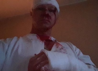 В полиции прокомментировали нападение на рязанского журналиста Комарова