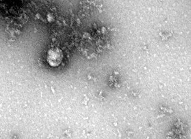 В Роспотребнадзоре сделали первое в мире фото «британского» штамма коронавируса