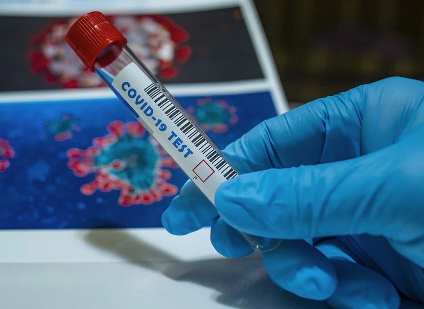 Более 3,5 тыс. рязанцев обследованы на коронавирус