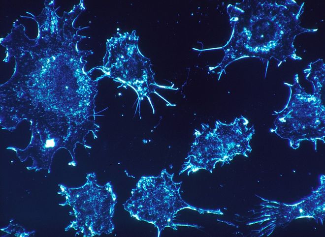 Ученые назвали семь основных симптомов рака