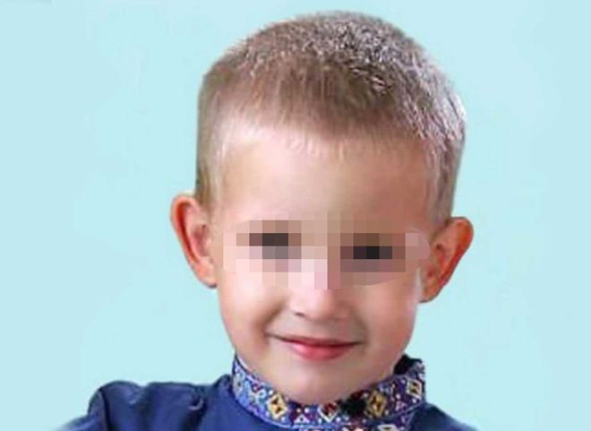 В Подмосковье от сильных ожогов погиб пятилетний мальчик