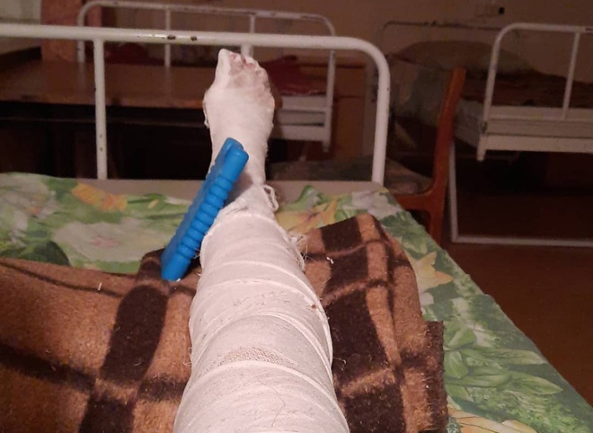В Рязани беременная женщина сломала ногу при выходе из маршрутки