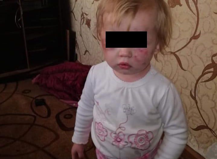 После избиения малышей в Рыбном на их мать завели уголовное дело