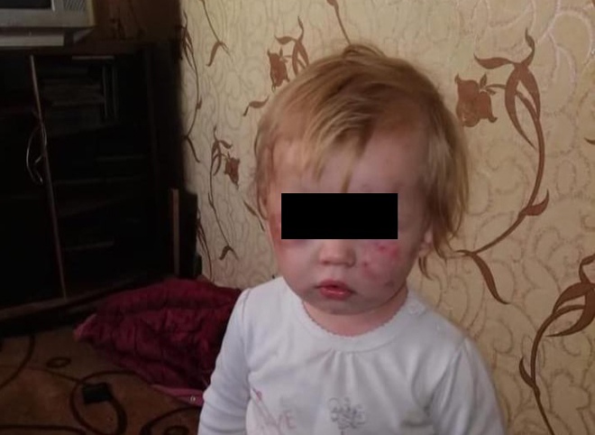 Полиция рассказала, кто избил доставленного в ОДКБ ребенка