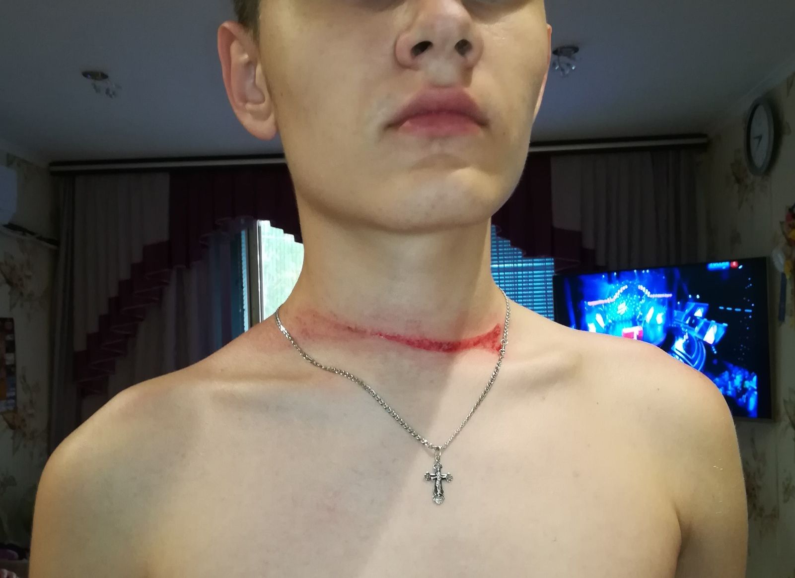 Касимовский подросток получил необычную травму, катаясь на велосипеде