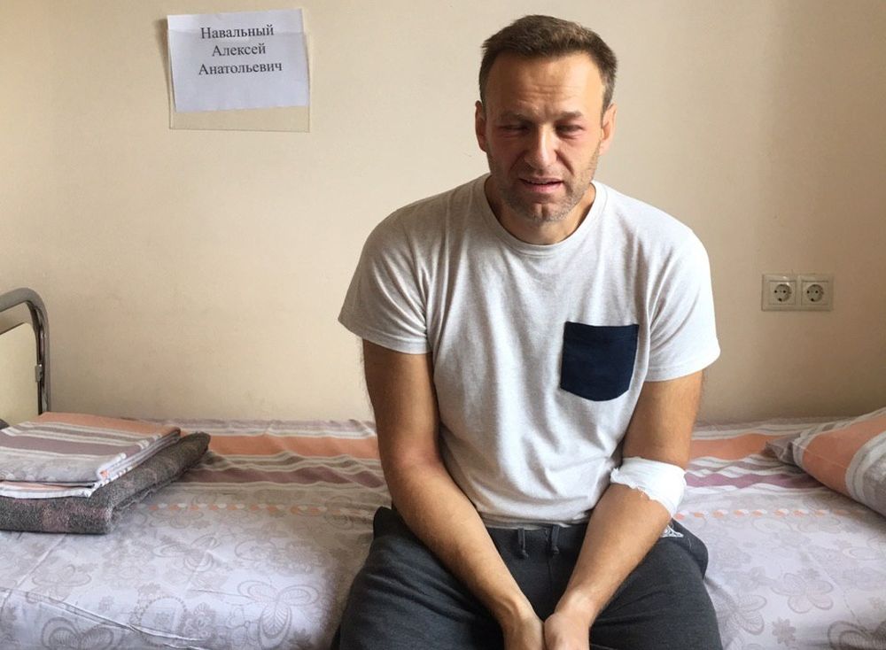 Алексей Навальный опубликовал фото после «острой аллергической реакции»