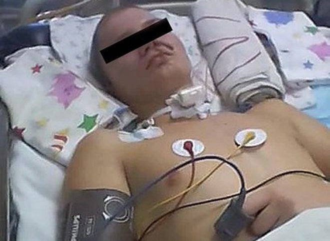 Избитого студента Рязанского педколледжа выписывают из московской клиники