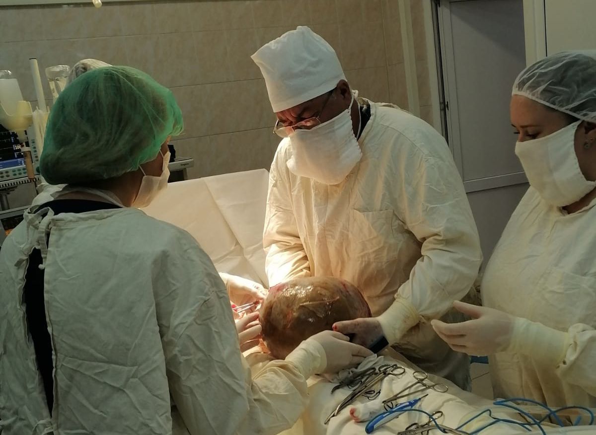 Рязанские хирурги вырезали у женщины восьмикилограммовую опухоль