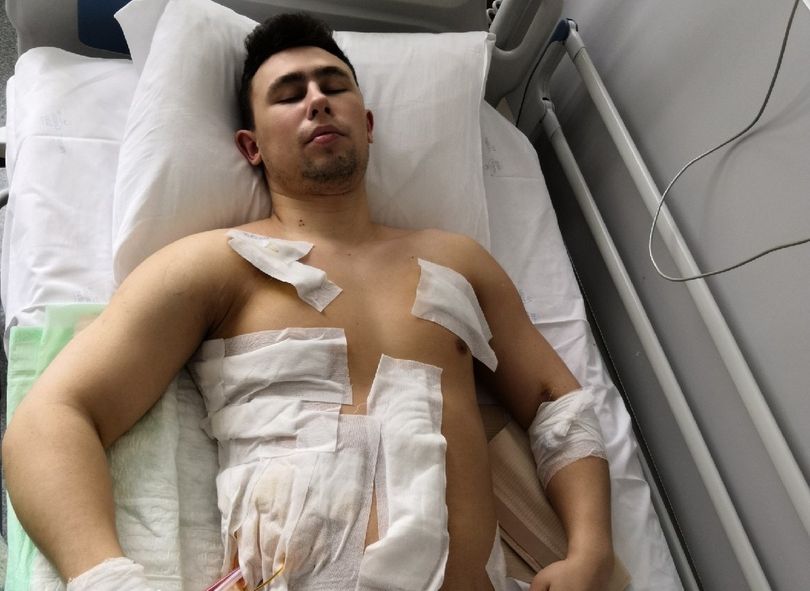 20-летний рязанец получил 12 ножевых ранений в баре в центре Москвы