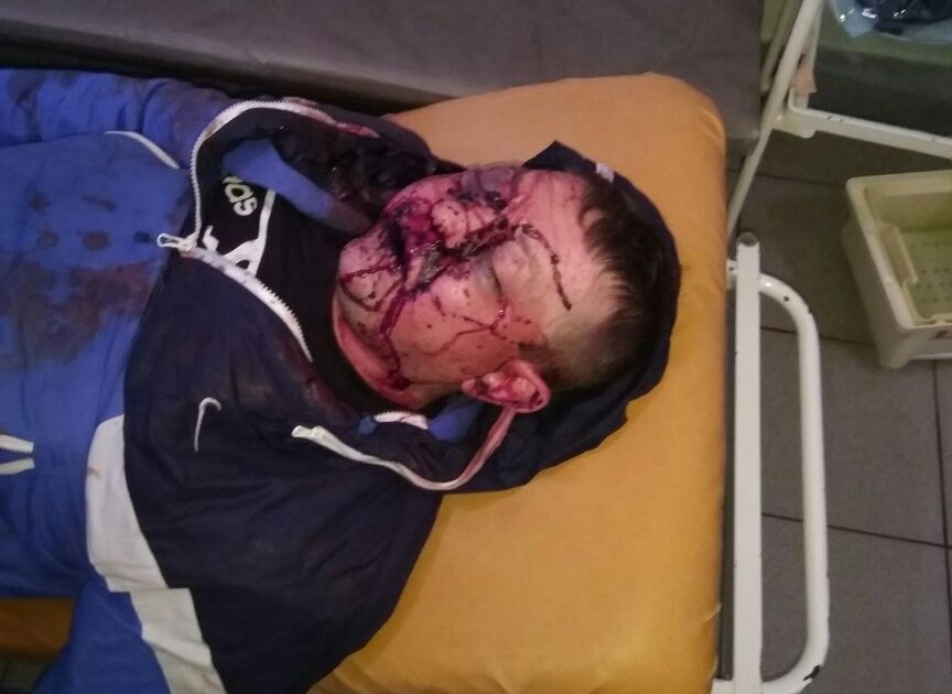 На улице Гагарина зверски избили 38-летнего мужчину