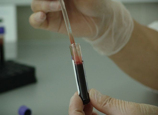 СМИ: российские врачи лечат больных коронавирусом кровью выздоровевших пациентов