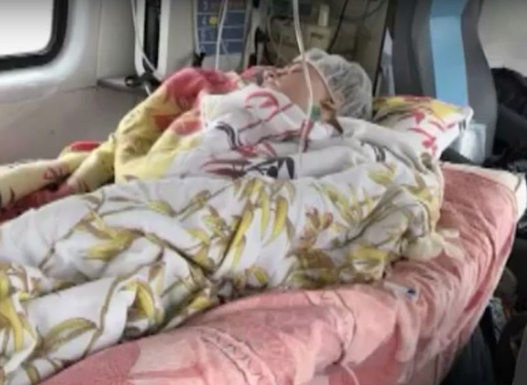 12-летней рязанке, которую ударило током на железной дороге, требуется помощь