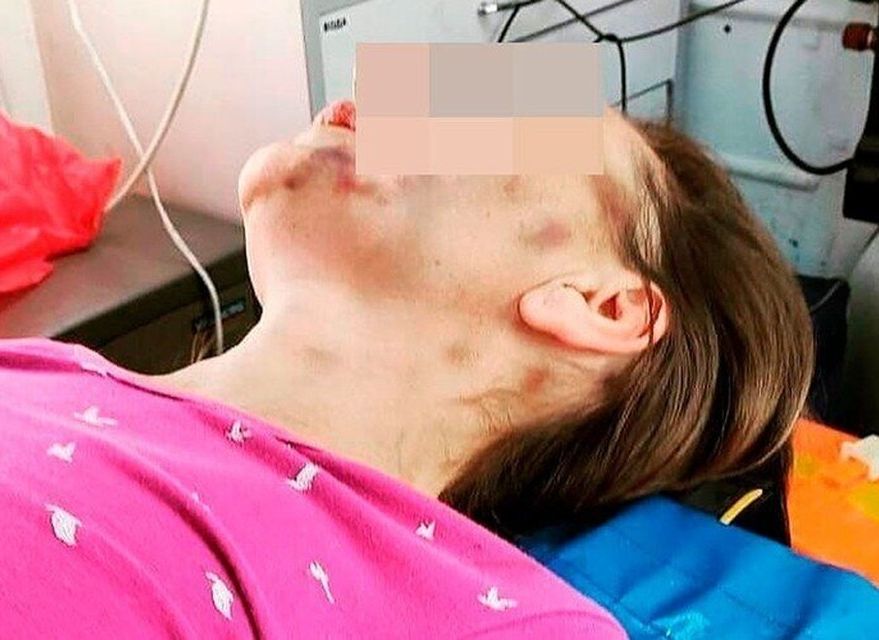 В Самарской области женщину оштрафовали за громкие крики во время избиения