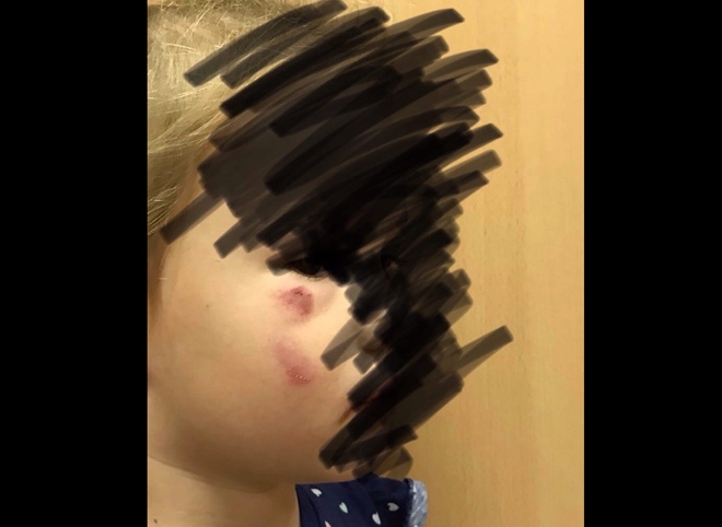 В рязанском торговом центре ребенок получил травму