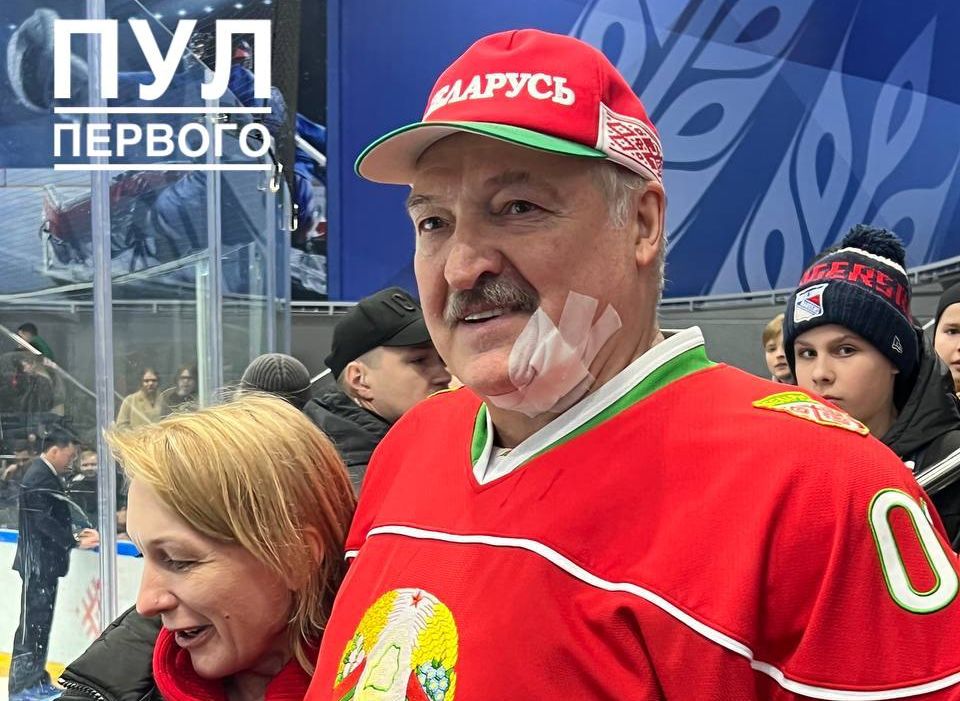 Лукашенко получил рассечение подбородка во время хоккейного матча