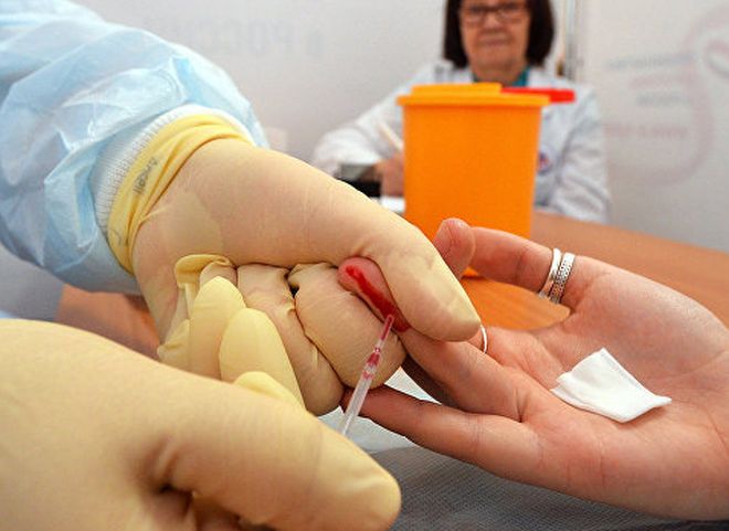 Роспотребнадзор: в России удалось остановить распространение ВИЧ