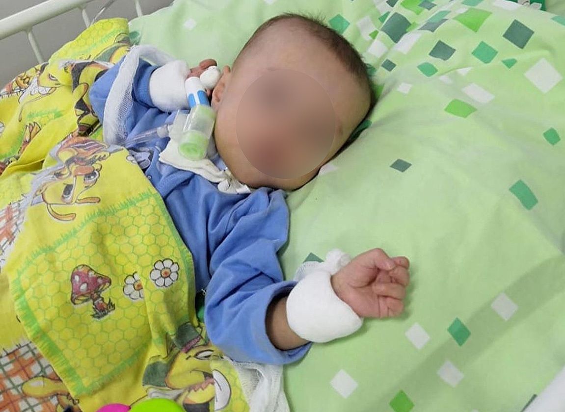 Скончался второй ребенок, не дождавшийся операции у уволенного хирурга Каабака