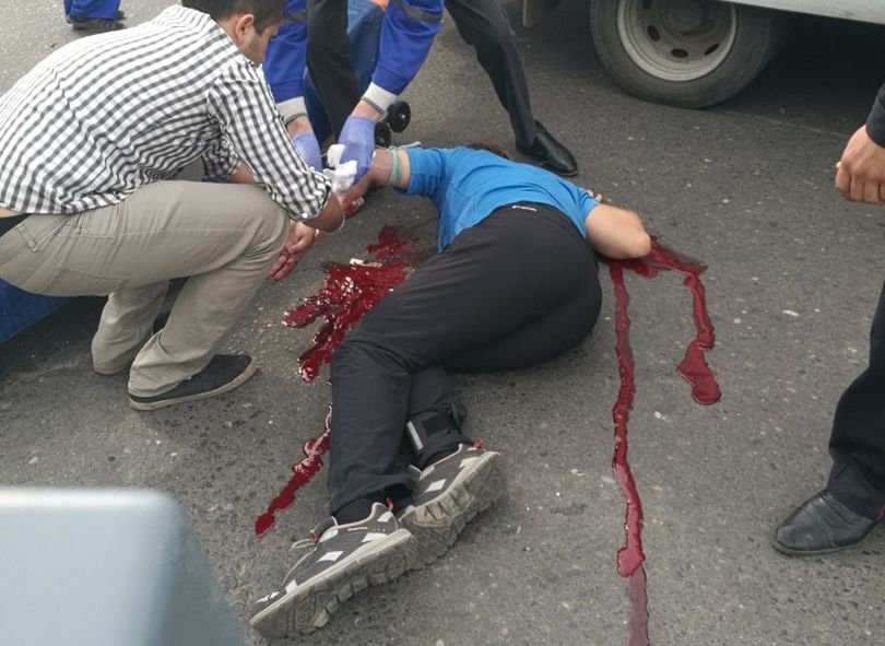 Стало известно о травмах, которые получил сбитый в центре Рязани велосипедист
