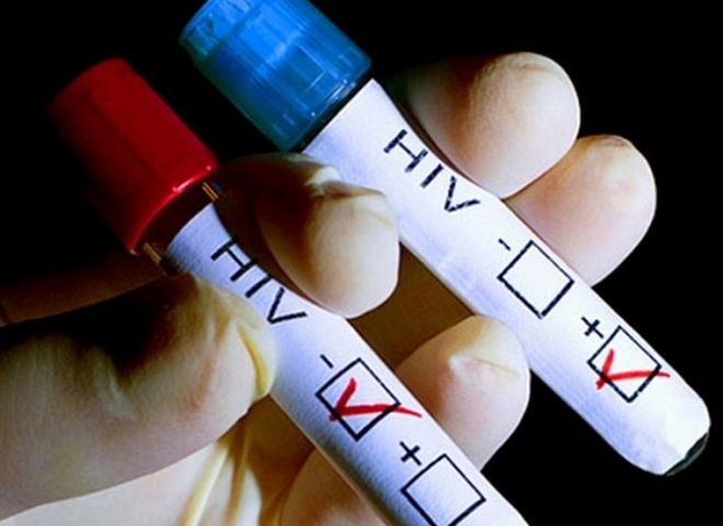 Минздрав будет вести регистры больных ВИЧ и туберкулезом