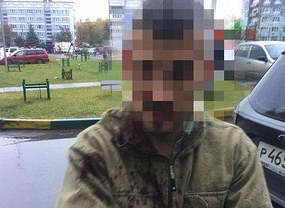 В Рязани арестован директор УК, проломивший череп владельцу квартиры