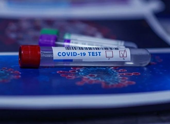 В Рязанской области 2 647 человек проходят тестирование на коронавирус