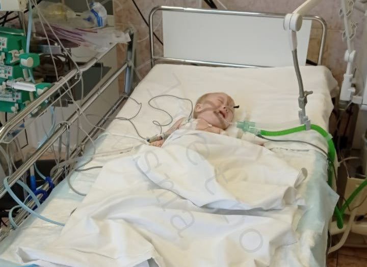 У малыша из Рязанской области, которому нужно лекарство за 150 млн, случился разрыв легкого
