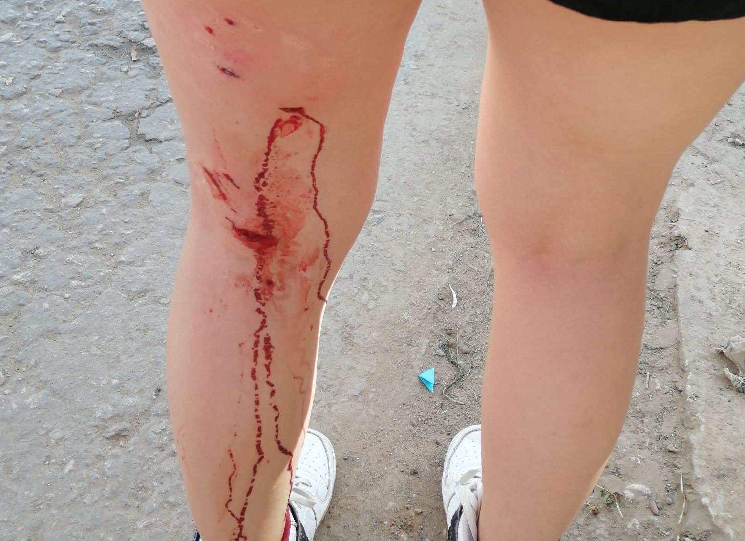 Появились подробности нападения собаки на девочку в Кальном