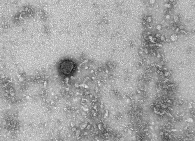 У коронавируса заметили «зловещие щупальца»