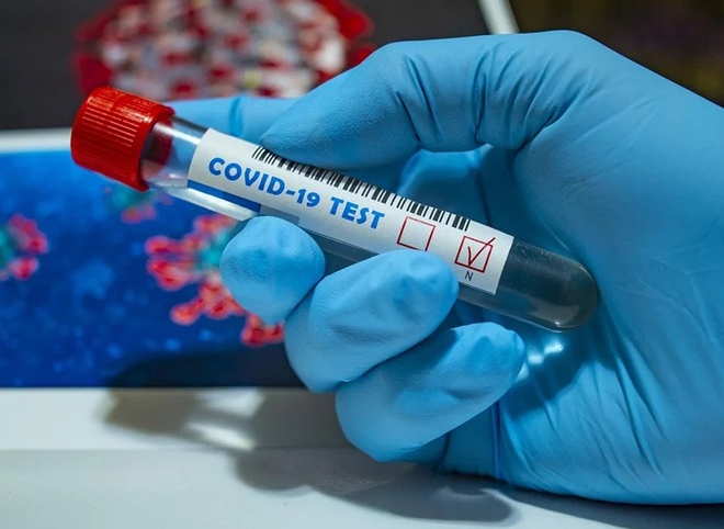 В Рязанской области выявлен еще 101 случай заражения коронавирусом