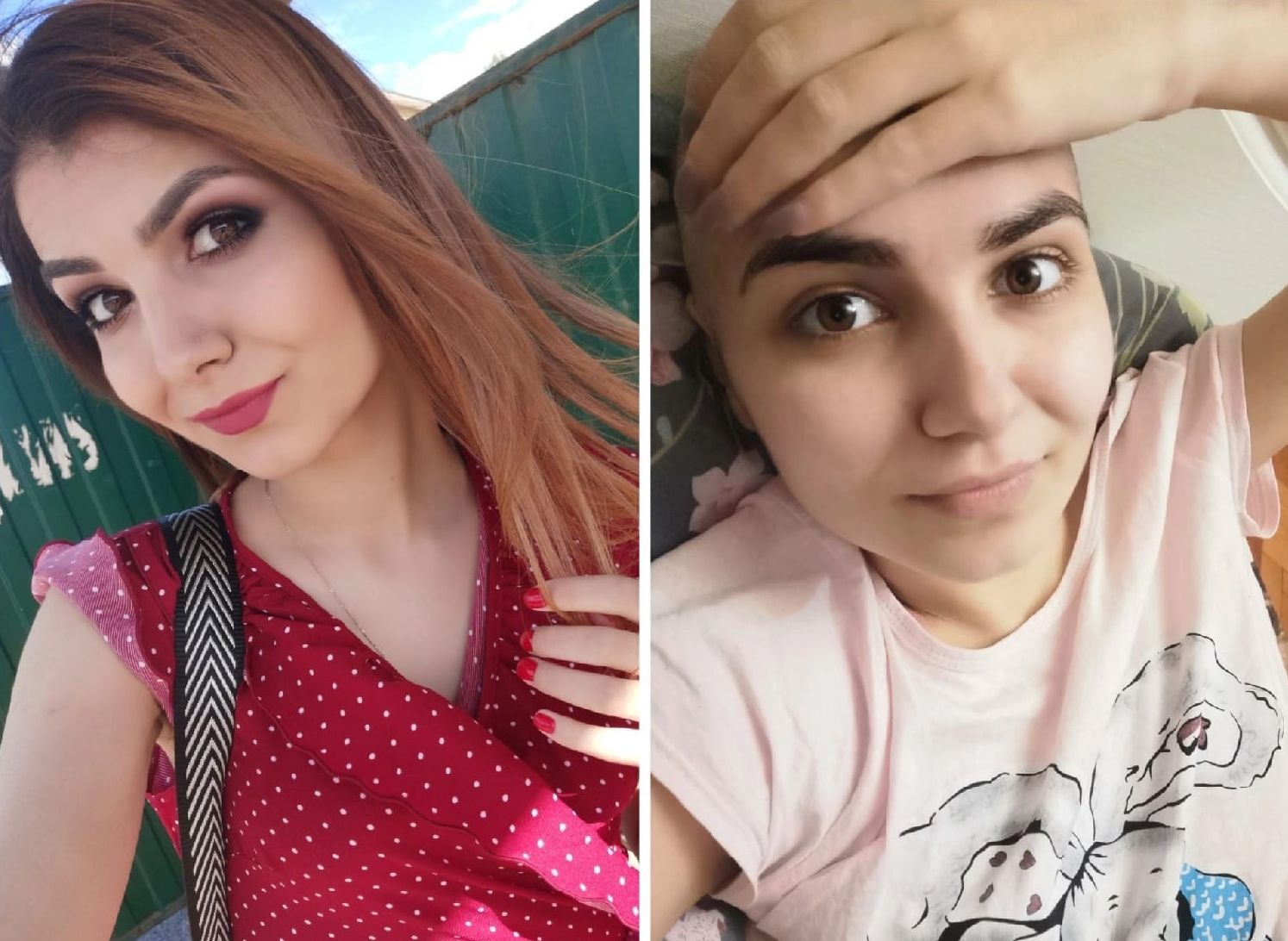 25-летней девушке из Касимова нужна помощь в борьбе с раком