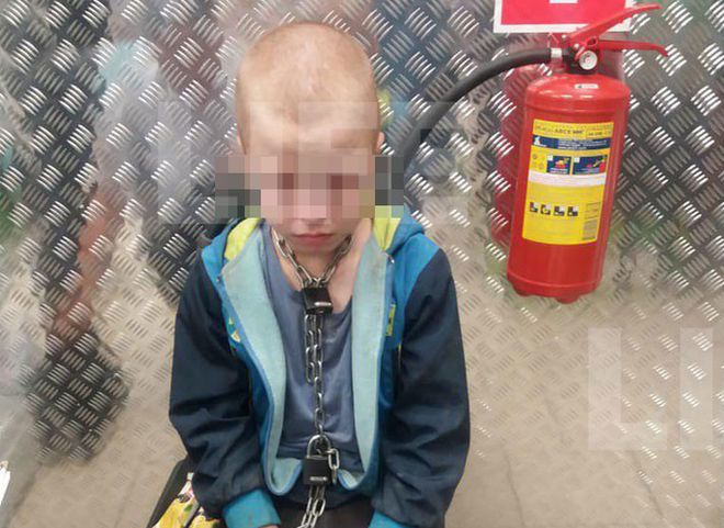 Житель Краснодарского края держал на цепи 10-летнего сына