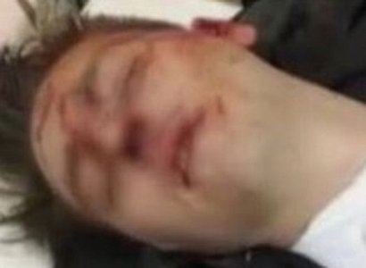 Молодого человека в рязанском баре избил бывший курсант МВД