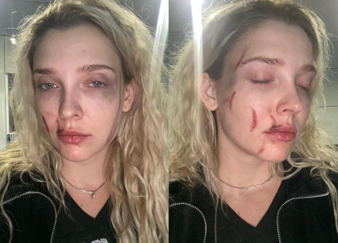 В московском клубе напали на экс-солистку группы «Мобильные блондинки»