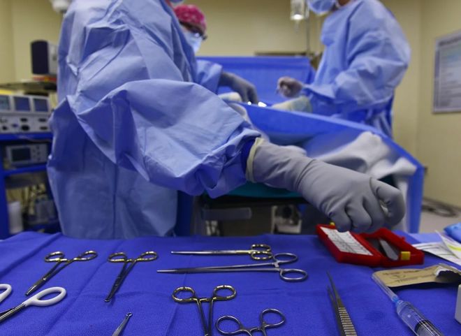 Рязанские хирурги удалили пациентке опухоль весом 30 кг