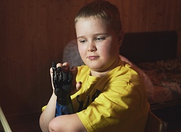 Ваня-терминатор. Мальчик из Рыбного девять лет живет с железной рукой